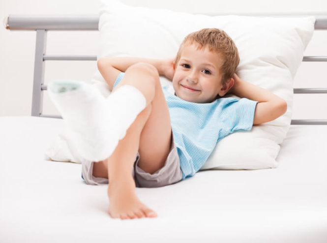 Leczenie złamania kości śródstopia odbywa się poprzez unieruchomienie kończyny.